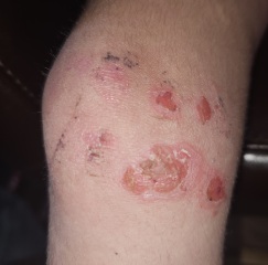 What is going on with DD's skin? Should I be worried?? Pic Attached