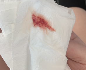 TW BLOOD PIC - advice!!
