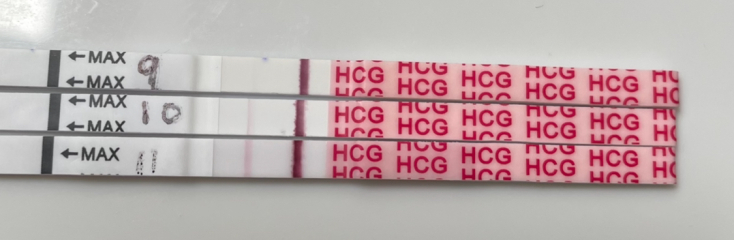 Any hope for poor line progression? Or should I resign myself to a chemical?