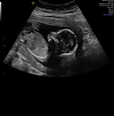 Girl or boy ????