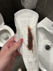 7 days brown to red bleeding? TW - IMAGES