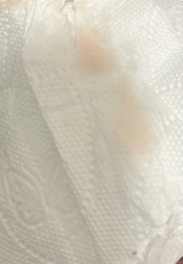 Could this be implantation bleeding??!