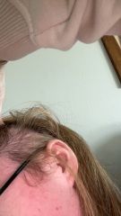Does this look like much hair loss.