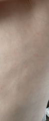 Thoughts on these spots