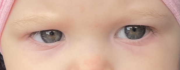 Really worried about my 9 month old… photos attached