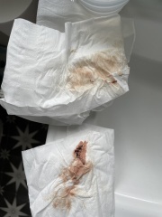 5 weeks and bleeding - advice please