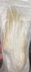38 weeks preg, what’s this in pad?
