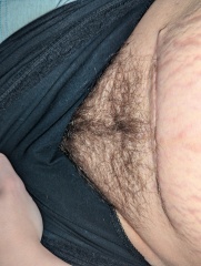 C-section incision has lumpy bits sticking out?