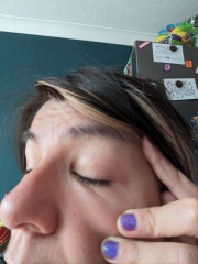 Boots nor Superdrug couldn't diagnose this, maybe one of you can?