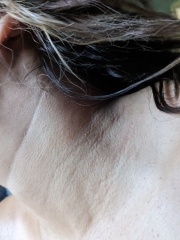 Boots nor Superdrug couldn't diagnose this, maybe one of you can?
