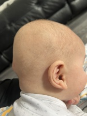 Spot on Back of head