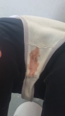 *pic attached* Help!! Implantation bleeding or not?