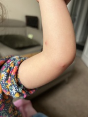 Spots?