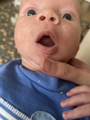 Tongue Tie?
