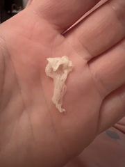 Vaginal discharge