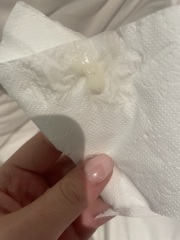 Strong smelling discharge but no answers *TW PICTURE ATTACHED*