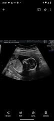 Boy or girl