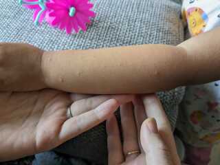 Any idea what these spots could be please?