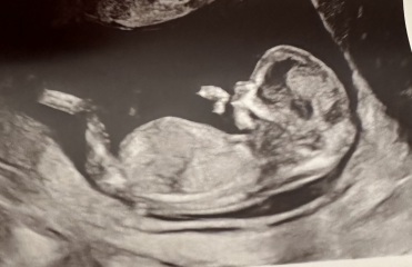 Boy or girl nub