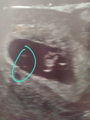 What are these on my scan?