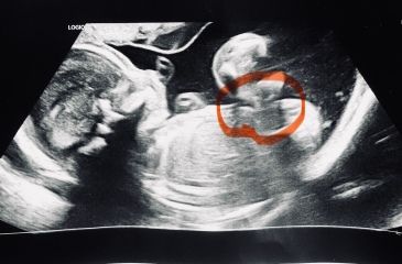 Have I ruined the gender surprise? :(