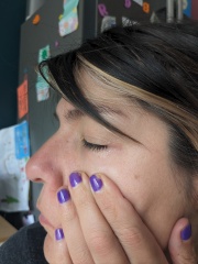 Boots nor Superdrug couldn't diagnose this, maybe one of you can?