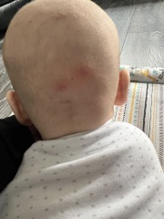 Spot on Back of head