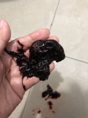 Is this my baby? I’m 4 weeks