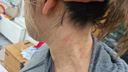 Boots nor Superdrug couldn't diagnose this, maybe one of you can?