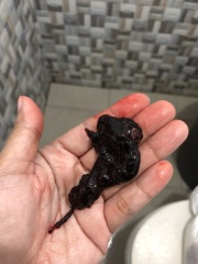 Is this my baby? I’m 4 weeks