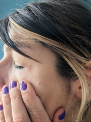 Boots nor Superdrug couldn't diagnose this, maybe one of you can?