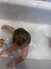 Baby abnormal head shape? - Thoughts please 