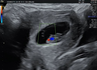 8 week abdominal scan - do I flip it?