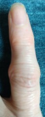 What's happening to my fingers?