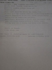 Hyperthyroidism-severe stomach cramps and retching