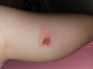 What is going on with DD's skin? Should I be worried?? Pic Attached