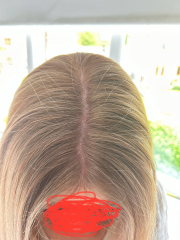 If you had your hair dyed yesterday, would these roots annoy you?