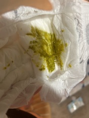 Is it dairy sensitivity?