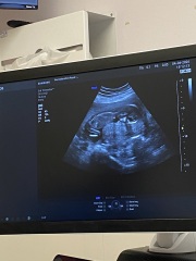 nub?