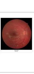 Any opticians?
