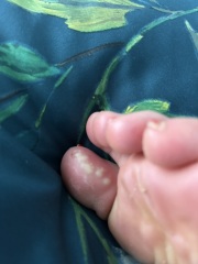 Pharmacist doesn't know what this is, do you?! (Foot)