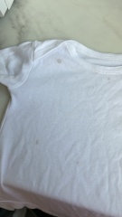 Is this staining from washing machine?!