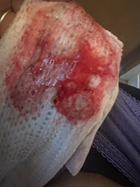 Help was it a chemical ? *sensitive image warning*