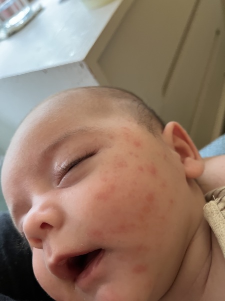 Aptamil pepti 1 - stick it out?