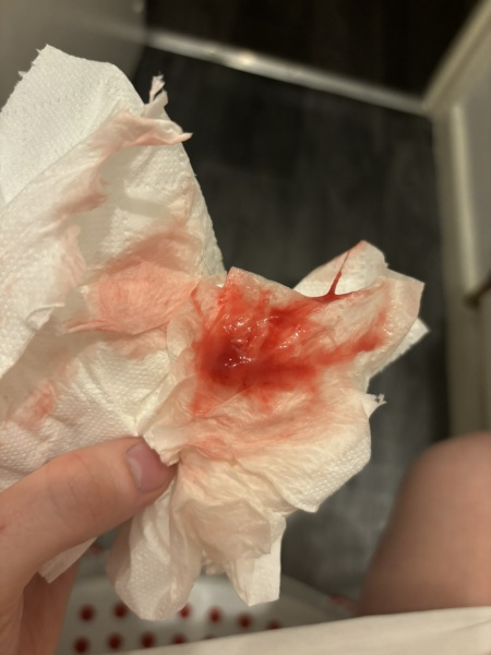 SENSITIVE Mucus Plug or just sensitive cervix?!