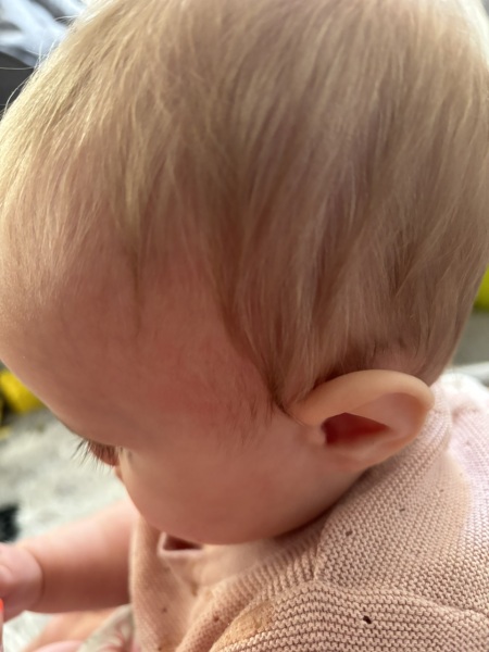 possible allergy?