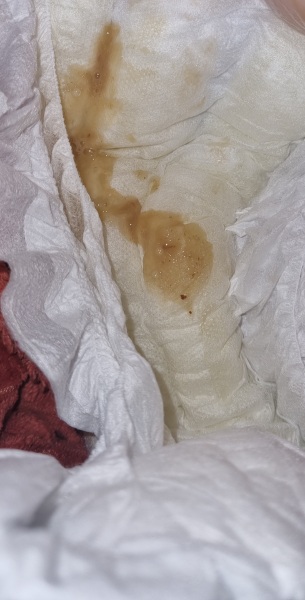 Toddler poop - it's a poo point