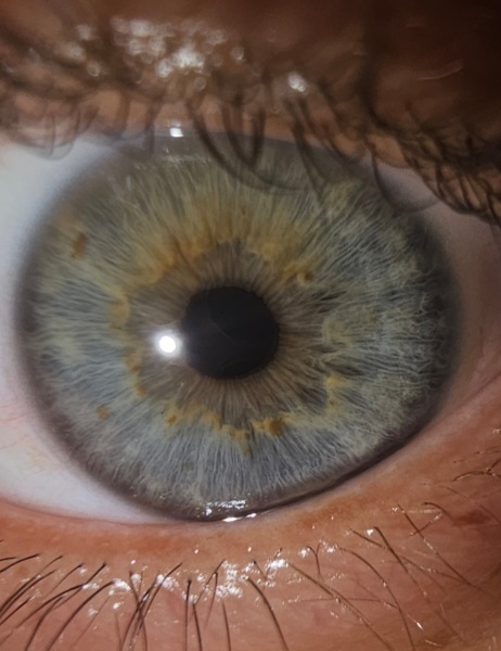 Settle an eye colour debate for me please?