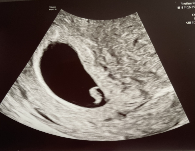 BFP after recent loss