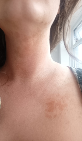 Any idea what this discolouration could be?